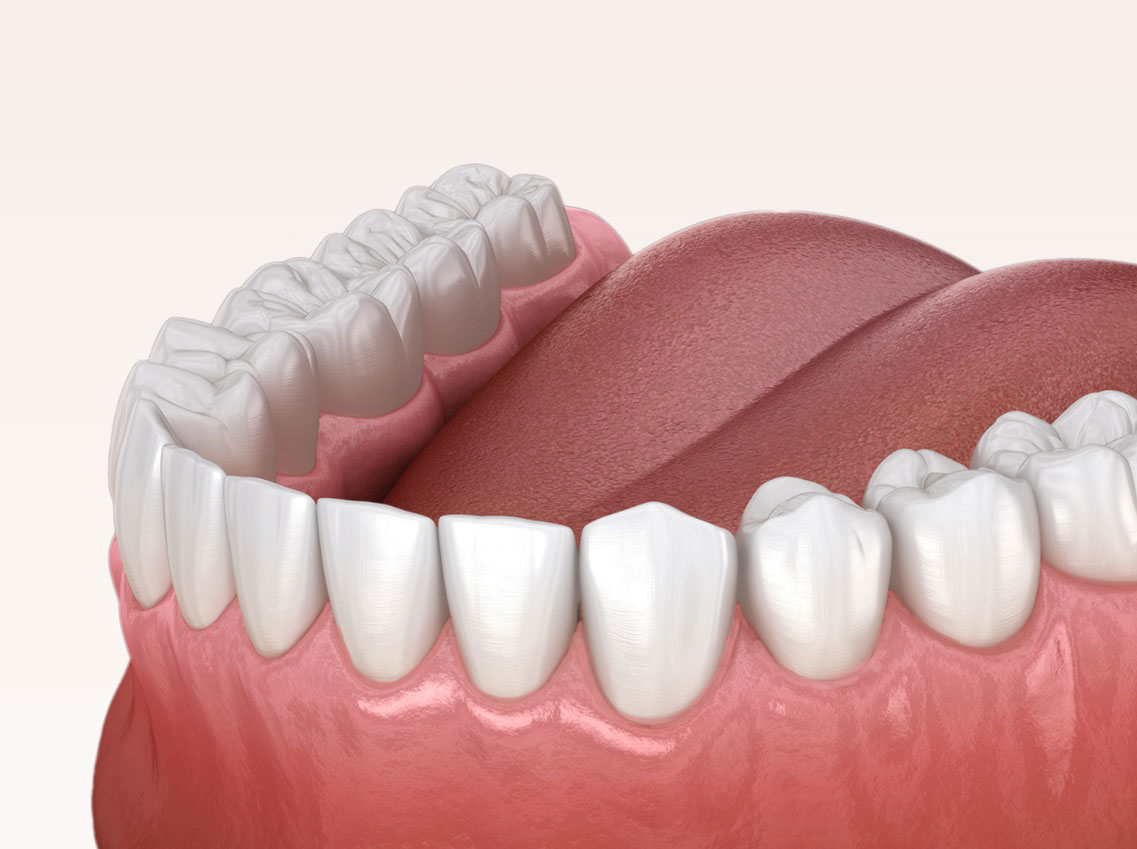 Zahnreinigung Dentalreinigung Meggen